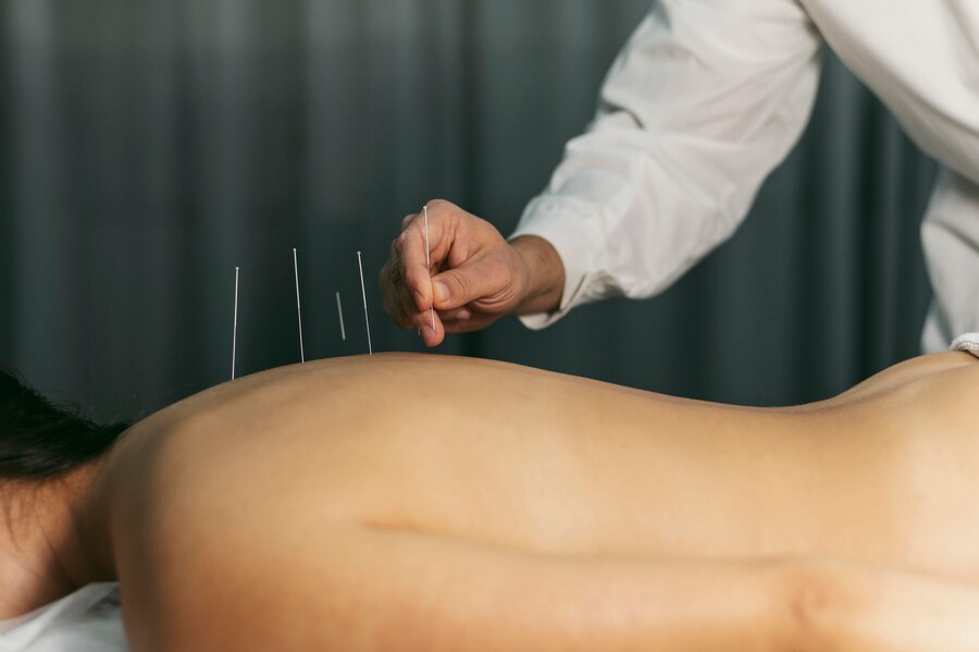 Dry needling Theraphy | Movmedphysio Physiotherapist near me
